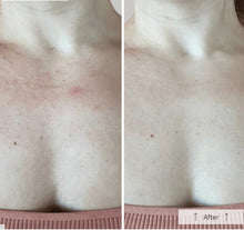 Load image into Gallery viewer, OMNILUX Neck & Décolleté